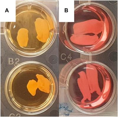 A Novel Ex Vivo Model of Aortic Valve Calcification. A Preliminary Report